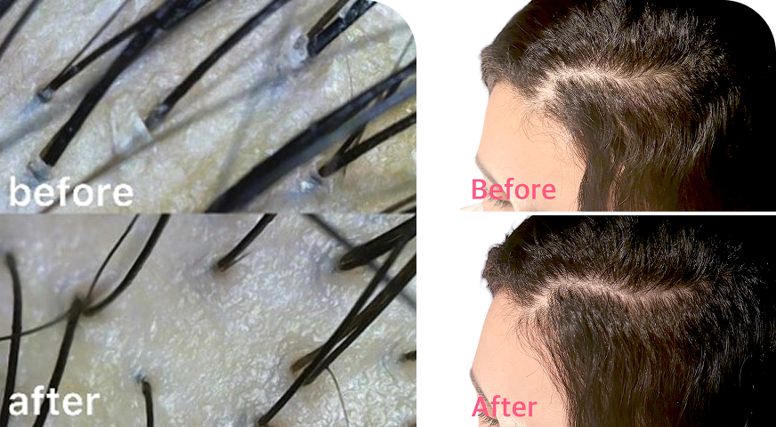 スカルプ＆ヘアーの単独メニュー ビフォーアフター