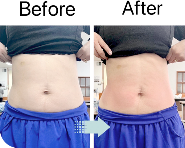 医療提携で結果にコミット ビフォーアフター